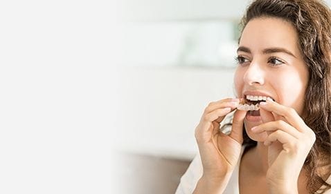 Invisalign special coupon