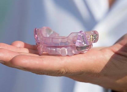 Hand holding an occlusal splint